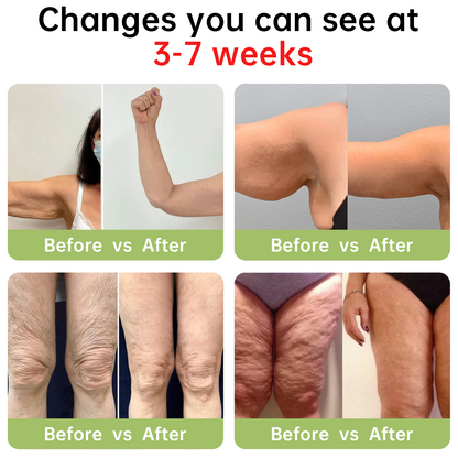 ✅Dobshow™ Luxury Collagen Peptide Firming Cream - Natural Ingredients - 🎖️Clinically Proven🎖️